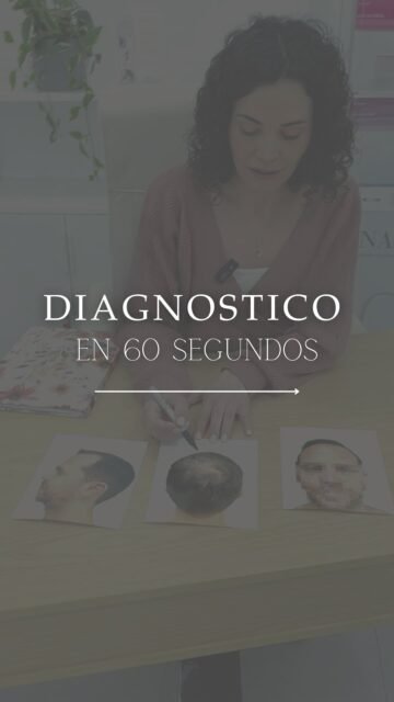 📢Cuando hablamos de alopecia androgenética, pérdida de densidad o afinamiento del cabello, lo importante no es solo lo visible… sino en qué fase estás y por qué está ocurriendo.

Porque dos casos que parecen iguales por fuera pueden necesitar planes completamente distintos.
🧠 En consulta analizamos:
✔️ Estado real del folículo (tricoscopio)
✔️ Evolución de la alopecia
✔️ Factores hormonales, genéticos o metabólicos
✔️ Y, sobre todo, qué margen de mejora tenemos en tu caso
A partir de ahí es cuando tiene sentido hablar de tratamiento, bioestimulación o mantenimiento.

📌 La clave no es hacer “de todo”, sino hacer lo que toca en el momento adecuado.

👩🏻‍⚕️ Dra. Vanessa Márquez
Medicina capilar
📍 Consulta en Lanzarote y Las Palmas de Gran Canaria
📞 680 73 14 53 | 📞 696 38 27 55

💬 ¿Te has visto reflejado en este tipo de casos?