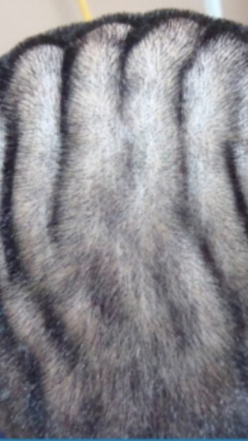 🧠 No, no es una forma “rara” del cráneo: es una condición del cuero cabelludo.

Se llama Cutis Verticis Gyrata y hace que la piel del cuero cabelludo forme pliegues y surcos profundos.
 Es poco frecuente: se estima en alrededor de 1 de cada 100.000 hombres y 1 de cada 400.000 mujeres.

📌 En estos casos, la valoración médica y una higiene cuidadosa del cuero cabelludo son fundamentales para evitar irritación e infección.

👩🏻‍⚕️ Dra. Vanessa Márquez
 Medicina capilar en Lanzarote y Las Palmas de Gran Canaria
 📞 680 73 14 53 | 📞 696 38 27 55

💬 ¿Conocías esta condición?