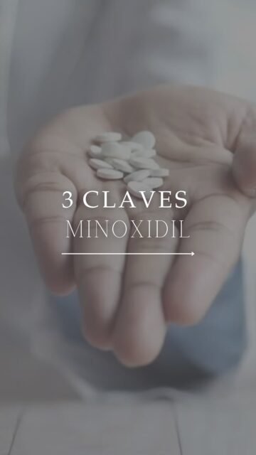 💊 3 cosas sobre el minoxidil que conviene saber antes de usarlo.

Si estás buscando tratamiento para la alopecia, la caída del cabello o has oído hablar del minoxidil, esto te interesa 👀

No es solo “me lo pongo y ya”:
 📌 no todas las alopecias son iguales (androgénica, areata, efluvio…)
 📌 puede haber fases como el shedding que confunden
 📌 y no todo el mundo necesita la misma pauta ni la misma forma (tópico u oral).

Por eso, en medicina capilar, lo importante es entender la causa y adaptar el tratamiento para mejorar la densidad capilar y la salud del folículo 🧠

👩🏻‍⚕️ Dra. Vanessa Márquez
 Especialista en alopecia · caída del cabello · minoxidil
 📍 Lanzarote y Las Palmas de Gran Canaria
 📞 680 73 14 53 | 696 38 27 55

💬 ¿Estás usando minoxidil o estás pensando en empezar?