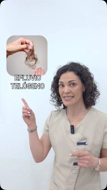 🚿 Si tu ducha o tu cepillo se llenan de pelo de repente… no siempre es alopecia.
Puede ser efluvio telógeno, una caída capilar frecuente tras estrés, infecciones, medicación o cambios importantes en el cuerpo.🧠
Y no se trata igual que otros tipos de alopecia. Por eso, antes de usar tratamientos por tu cuenta, lo importante es entender la causa.
👩🏻⚕️ Dra. Vanessa Márquez
Medicina capilar · Efluvio telógeno · Caída del cabello
📍 Lanzarote y Las Palmas de Gran Canaria
📞 680 73 14 53 | 696 38 27 55
💬 ¿Te ha pasado después de una etapa intensa?