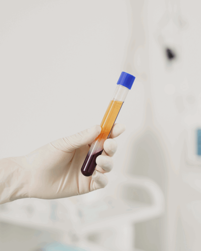Bioestimulación con Plasma